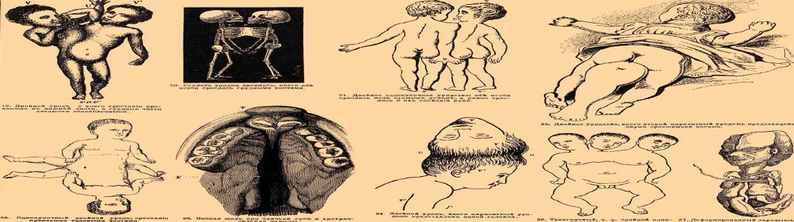 Free Speech. ������� �����. ���� ������ ����������. 