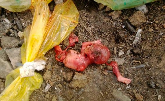 Free Speech. ������� �����. ���� ������ ����������.